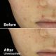 Serum exfoliant cu AHA 2% si BHA 2%, 50 g, Cosrx 659681